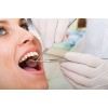 Dental Cleaning